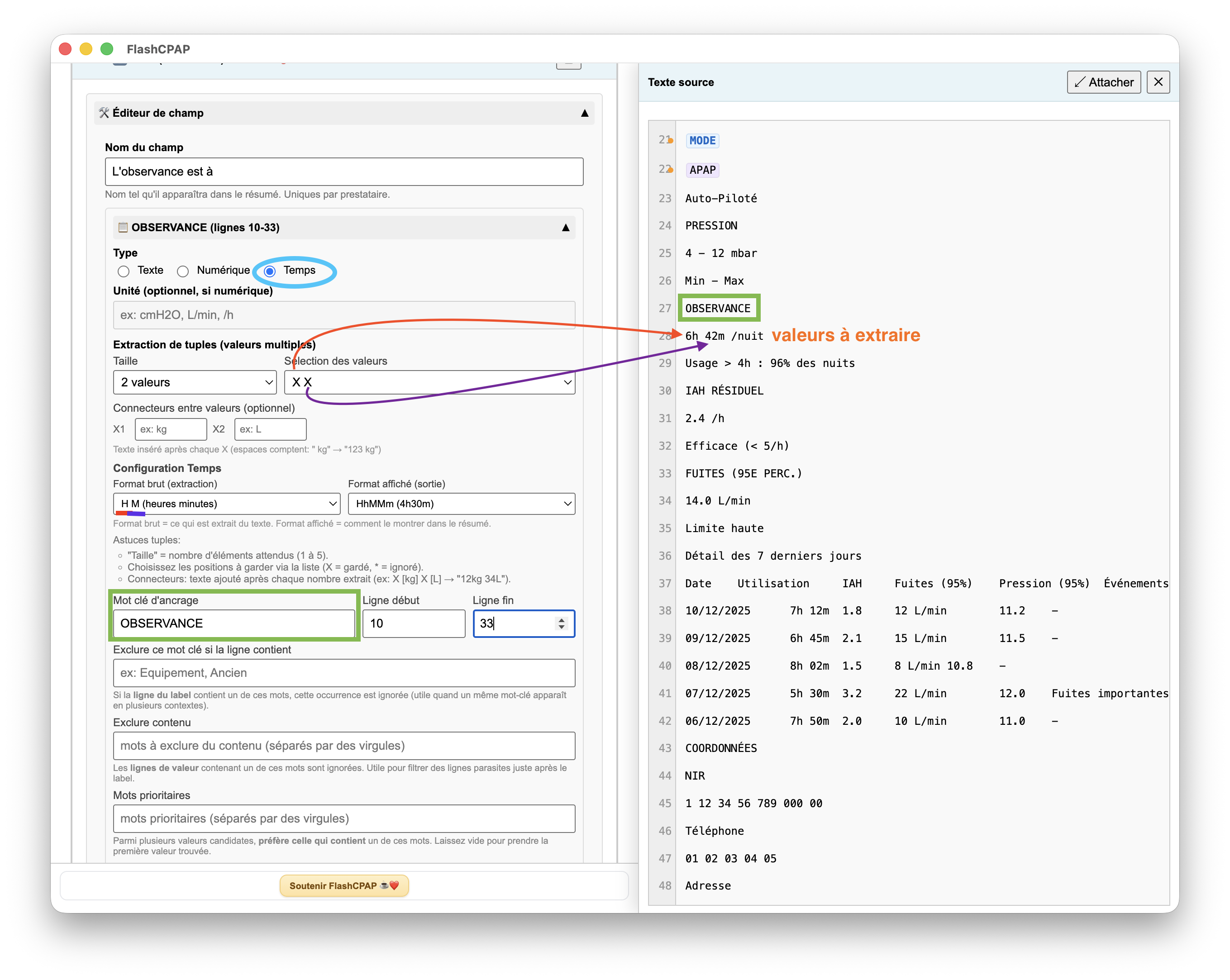 Étape 3B — Configuration du champ Temps